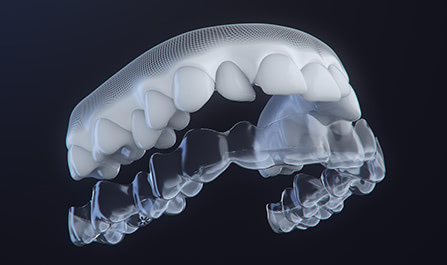 テクノロジーを用いた明瞭な治療