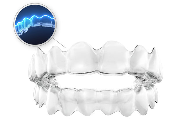 お口の中のトラブルを起こしにくい